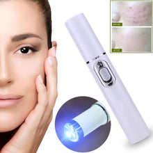 Load image into Gallery viewer, Medical Blue Light Therapy Laser Treatment Pen - Dreamy Hot Deals